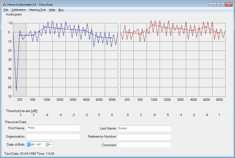 Download http://www.findsoft.net/Screenshots/Home-Audiometer-Hearing-Test-20132.gif