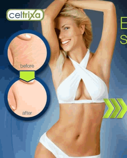 Download http://www.findsoft.net/Screenshots/Stretch-Mark-Removal-58888.gif